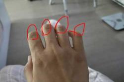 月子里手指关节疼咋回事