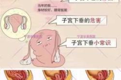 产后三月漏尿怎么办