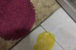 产后有黄水怎么回事