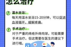 产后痔疮疼痛咋缓解