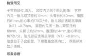 新小区不适合备孕吗