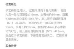 新小区不适合备孕吗