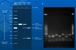 新生儿电泳是什么