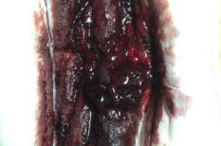 流产后流鲜血正常吗