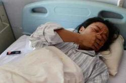 剖腹产站立为何会头疼