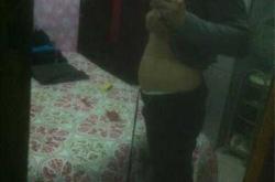 孕十一周突然孕反明显怎么办