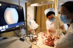 婴儿眼底检查有必要吗