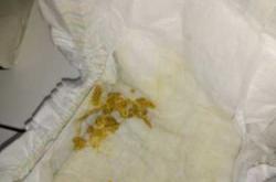 新生儿大便水便分离咋回事
