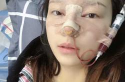 肋骨拍x片影响备孕吗