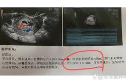 流产后几天需复查？