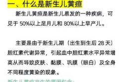 新生儿黄疸原因是什么
