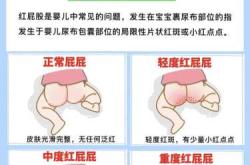 新生儿屁屁红怎么办