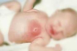 新生儿哪些表现不正常