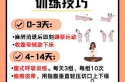 剖腹产产后6天需注意什么