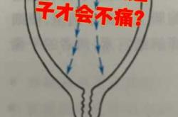 自然流产后一直怀不上咋回事