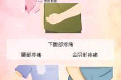 剖腹产后同房疼痛是怎么回事