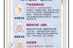 廊坊产后恢复有哪些方式