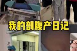 剖腹产要剖腹七层吗