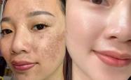 产后脸色暗黄怎么办