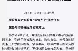 剖腹产第三胎隔一年半可行吗