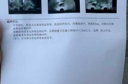 服用西比灵多久可备孕