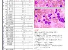 新生儿血小板高是怎么回事