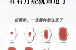 产后月经来得早好还是晚好