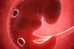 打肝素钙恶心是孕反吗