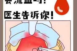 顺产剖腹产哪个更痛