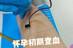 血常规检查能查怀孕吗