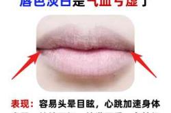 孕反嘴巴淡怎么办