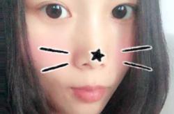 婴儿总抓头抓脸是怎么回事