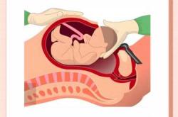 顺产后子宫增大是怎么回事