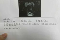 6周5天孕反消失正常吗