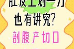 剖腹产如何选吉时