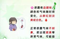 产后恶露是褐色正常吗