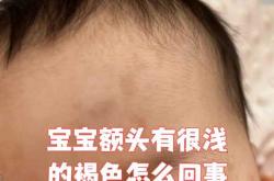 婴儿额头平是怎么回事