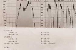 产后检查需要做内检吗