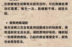 如何治剖腹产疤痕效果好