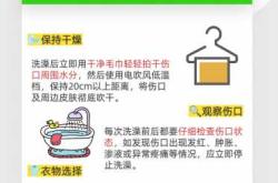 剖腹产后多久能碰冷水