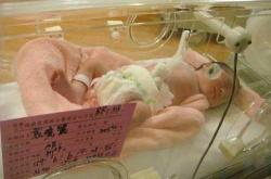 婴儿为什么会出现月经现象