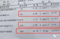 甲减备孕男性可饮酒吗