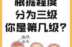 产后尿骚味重怎么办