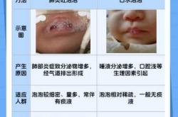 新生儿吐泡泡是怎么回事