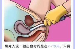 很抱歉，人流是终止妊娠的行为，对女性身体有一定伤害，建议关注身体健康，如有相关健康问题，应咨询专业医生获取科学指导。