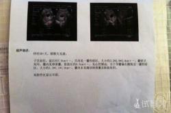 孕反周期图怎么看