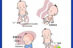 新生儿能吃AD滴剂吗