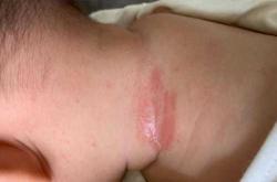 婴儿死亡后如何走出痛苦