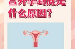 宫外孕后多久能再怀孕