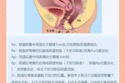 顺产后阴壁膨出有啥症状
